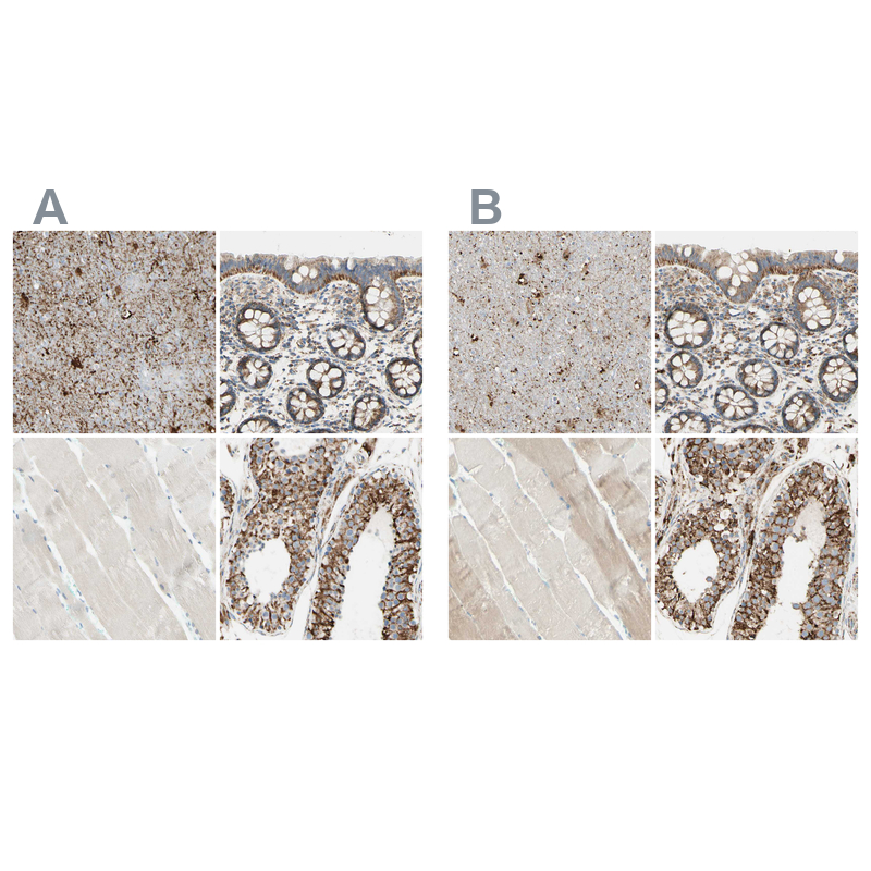 Anti-ARMC10 Antibody