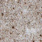 Immunohistochemical staining of human cerebral cortex shows strong granular cytoplasmic positivity in neurons.