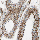 Anti-ARMC10 Antibody