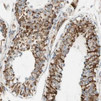 Immunohistochemical staining of human testis shows strong granular cytoplasmic positivity in cells in seminiferous ducts.