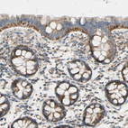 Immunohistochemical staining of human colon shows moderate to strong granular cytoplasmic positivity in glandular cells.