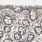 Immunohistochemical staining of human colon shows moderate to strong granular cytoplasmic positivity in glandular cells.