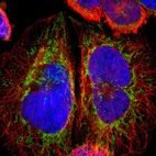 Immunofluorescent staining of human cell line A-431 shows localization to mitochondria.