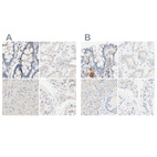 Anti-MANEA Antibody
