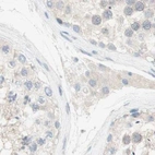 Immunohistochemical staining of human testis using Anti-MANEA antibody HPA011069.