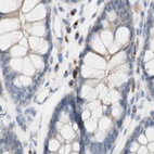 Immunohistochemical staining of human colon using Anti-MANEA antibody HPA011069.