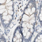 Immunohistochemical staining of human colon using Anti-MANEA antibody HPA011069.