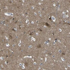 Immunohistochemical staining of human cerebral cortex shows strong cytoplasmic positivity in neurons.