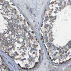 Immunohistochemical staining of human testis shows strong membranous positivity in cells in seminiferous ducts.