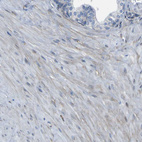 Immunohistochemical staining of human prostate shows weak cytoplasmic positivity in smooth muscle cells.