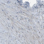 Immunohistochemical staining of human prostate shows weak cytoplasmic positivity in smooth muscle cells.