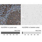 Anti-HLA-DPB1 Antibody