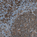 Anti-HLA-DPB1 Antibody