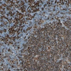 Immunohistochemical staining of human lymph node shows strong membranous positivity in germinal center cells.