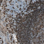 Immunohistochemical staining of human tonsil shows strong membranous positivity in germinal center cells and non-germinal center cells.