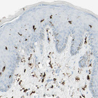 Immunohistochemical staining of human skin shows moderate to strong cytoplasmic positivity in epidermal cells.