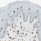 Immunohistochemical staining of human skin shows moderate to strong cytoplasmic positivity in epidermal cells.