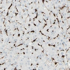 Immunohistochemical staining of human liver shows strong cytoplasmic positivity in Kupffer cells.