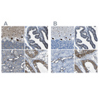 Anti-STIM1 Antibody