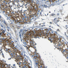Immunohistochemical staining of human testis shows strong cytoplasmic positivity in cells in seminiferous ducts.