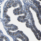 Anti-STIM1 Antibody