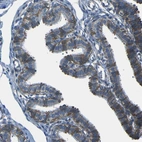 Immunohistochemical staining of human fallopian tube shows strong cytoplasmic positivity in glandular cells.