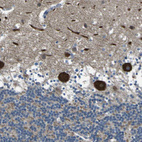 Anti-STIM1 Antibody