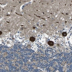 Immunohistochemical staining of human cerebellum shows strong cytoplasmic positivity in Purkinje cells.
