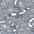 Immunohistochemical staining of human kidney shows strong cytoplasmic positivity in cells in tubules.