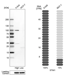 Western blot analysis in human cell lines A-549 and MCF-7 using Anti-STIM1 antibody. Corresponding STIM1 RNA-seq data are presented for the same cell lines. Loading control: Anti-HSP90B1.