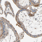 Anti-SEMA4C Antibody