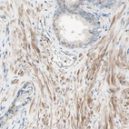Immunohistochemical staining of human prostate shows moderate cytoplasmic positivity in smooth muscle cells.