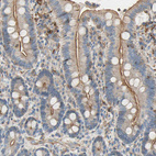 Anti-SEMA4C Antibody