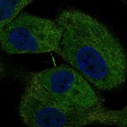 Anti-JPT1 Antibody