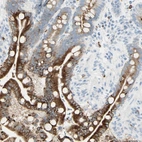 Immunohistochemical staining of human colon shows high expression.
