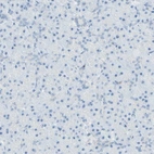 Immunohistochemical staining of human pancreas shows low expression as expected.