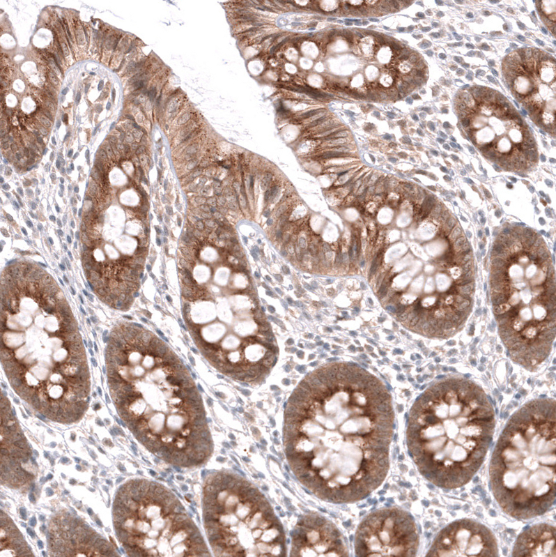 Anti-SPINT2 Antibody