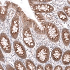 Anti-SPINT2 Antibody