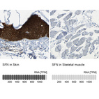 Anti-SFN Antibody