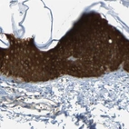 Immunohistochemical staining of human skin shows high expression.