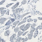 Immunohistochemical staining of human skeletal muscle shows low expression as expected.