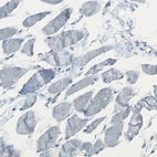 Immunohistochemical staining of human skeletal muscle shows low expression as expected.