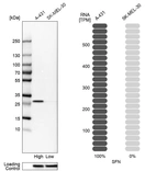 Western blot analysis in human cell lines A-431 and SK-MEL-30 using Anti-SFN antibody. Corresponding SFN RNA-seq data are presented for the same cell lines. Loading control: Anti-HSP90B1.