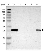 Anti-SFN Antibody