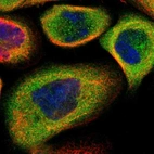 Immunofluorescent staining of human cell line A-431 shows localization to cytosol.