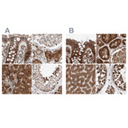 Anti-ZSCAN29 Antibody