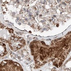 Immunohistochemical staining of human kidney using Anti-ZSCAN29 antibody HPA011109.