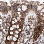 Immunohistochemical staining of human colon using Anti-ZSCAN29 antibody HPA011109.