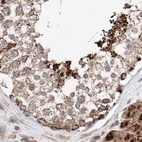 Immunohistochemical staining of human testis using Anti-ZSCAN29 antibody HPA011109.
