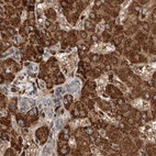 Immunohistochemical staining of human liver using Anti-ZSCAN29 antibody HPA011109.